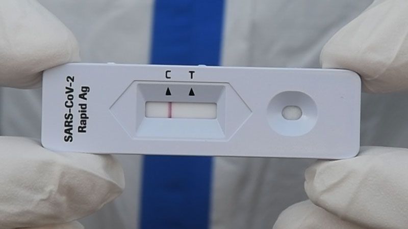 Der PoC-Antigen-Schnelltest  liefert nach nur 20 Minuten ein Ergebnis. | Foto: HamburgNews