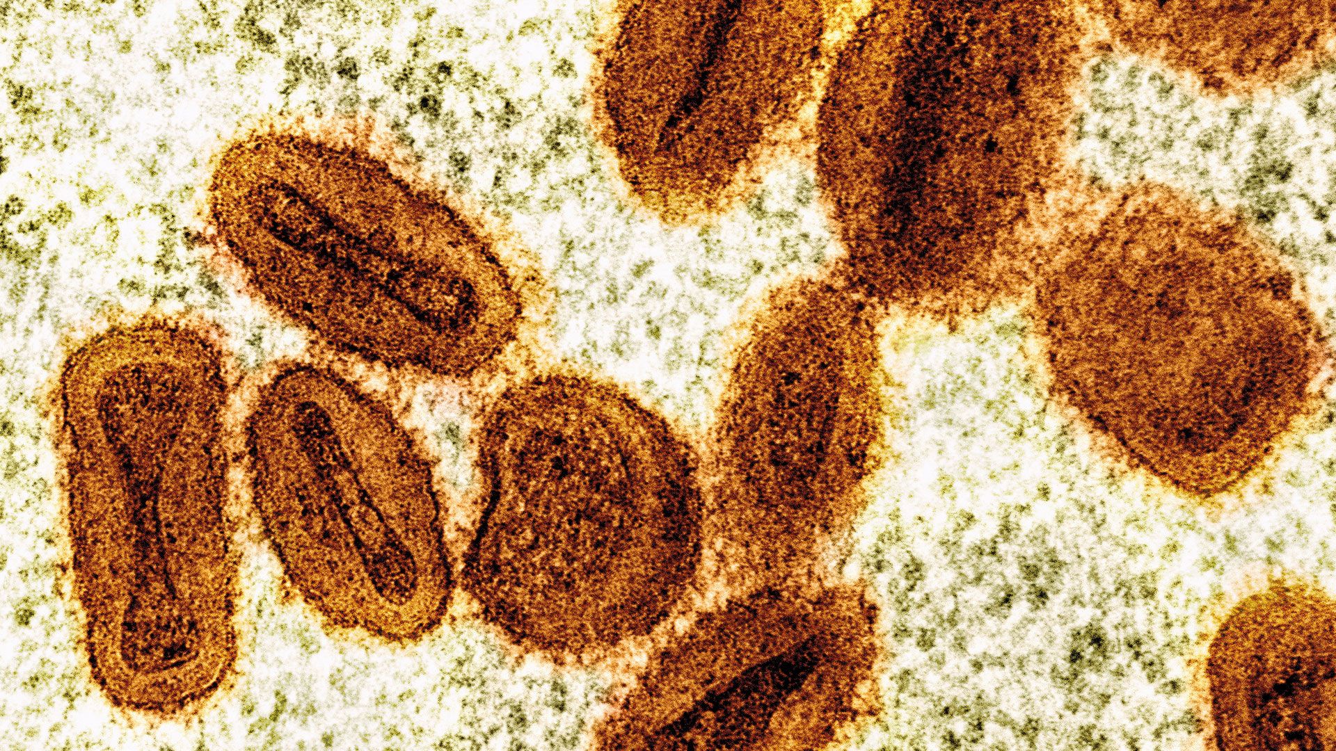 Im Landkreis Harburg wurde das Mpox-Virus festgestellt. Foto: By NIAID - https://www.flickr.com/photos/niaid/53848503464/, CC BY 2.0, https://commons.wikimedia.org/w/index.php?curid=151672169